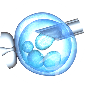 Fertilizacao In Vitro