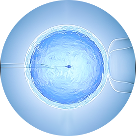 Fertilização In Vitro