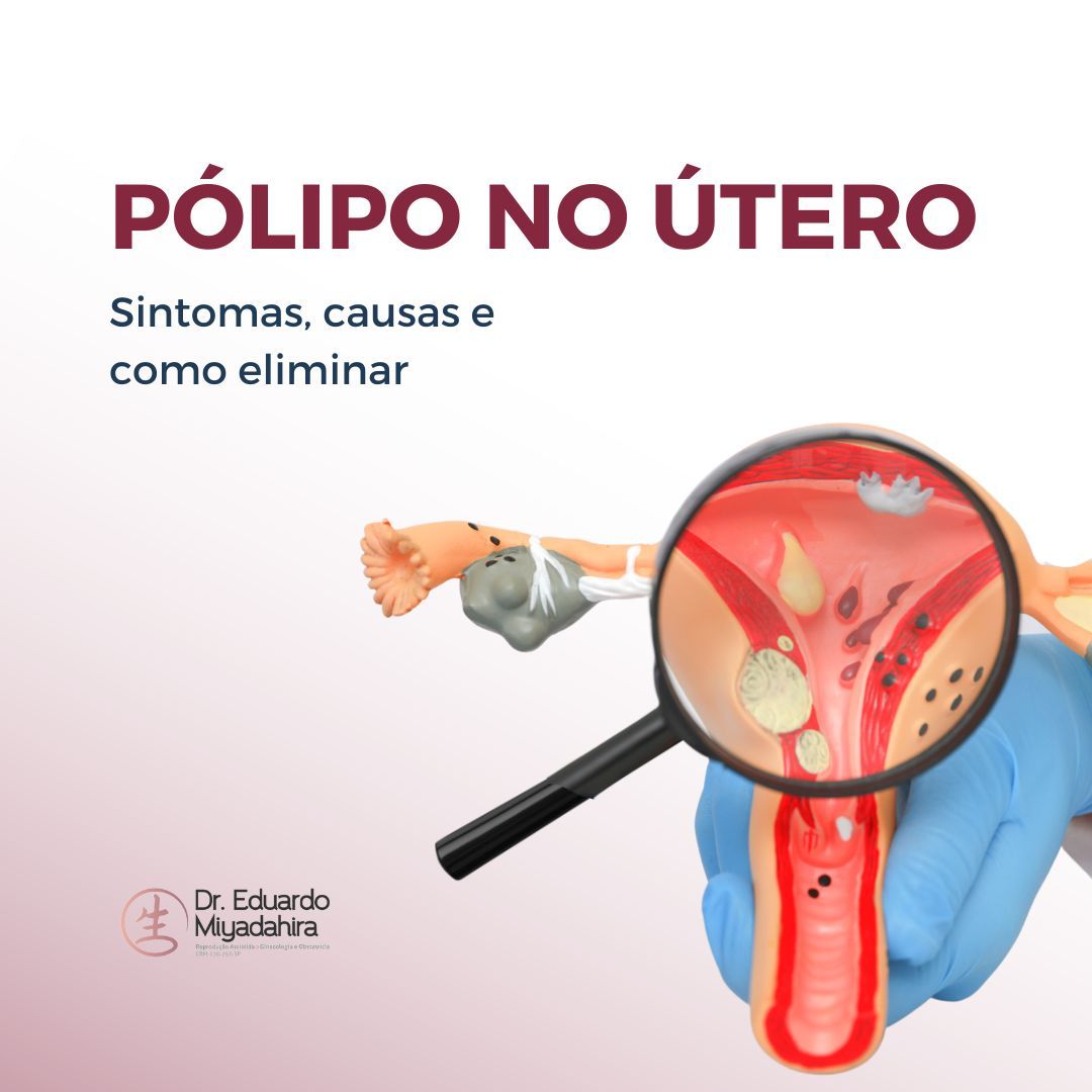 pólipo no útero