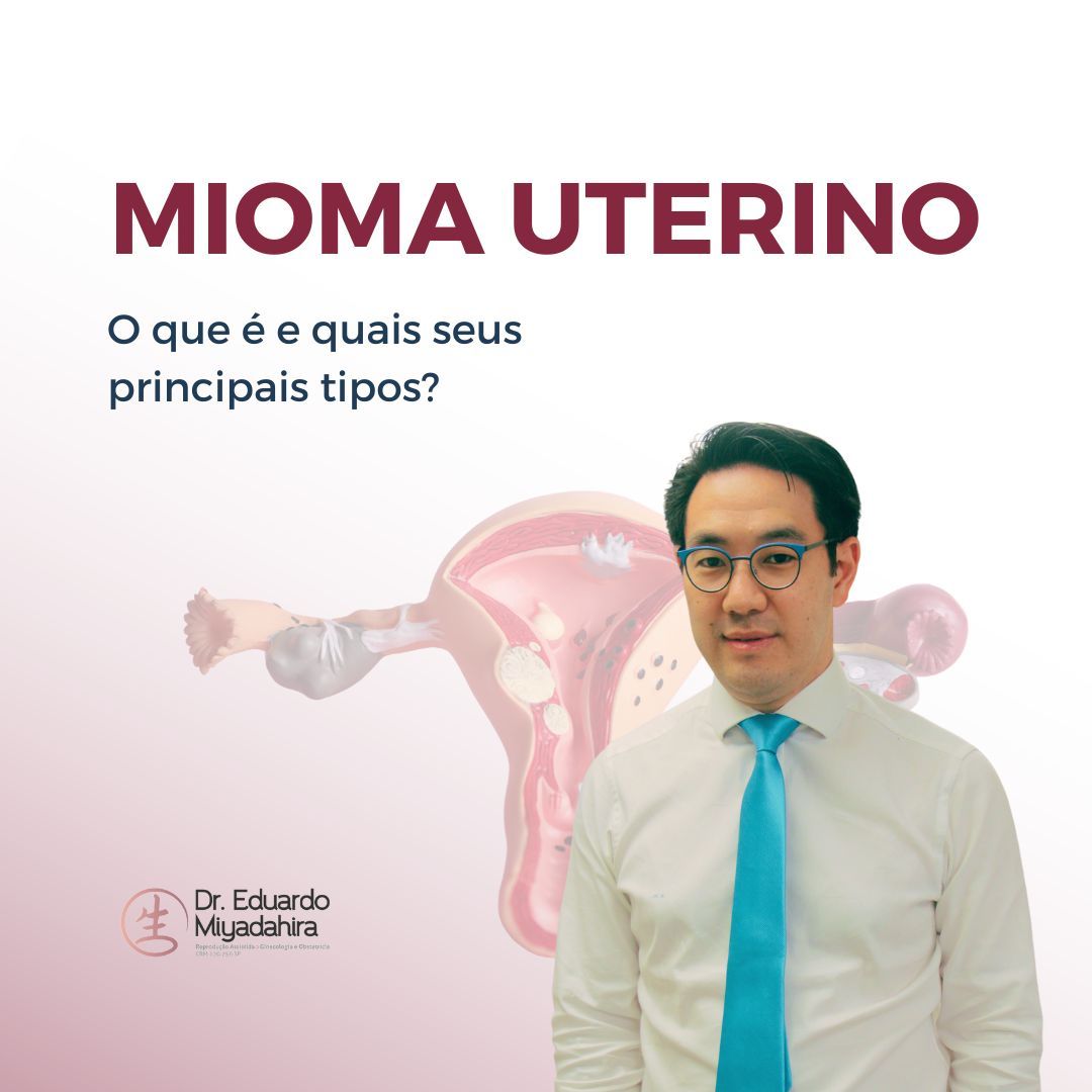 mioma uterino